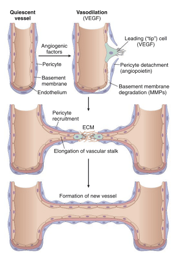 Diagram detailing the steps of capillary sprouting during angiogenesis