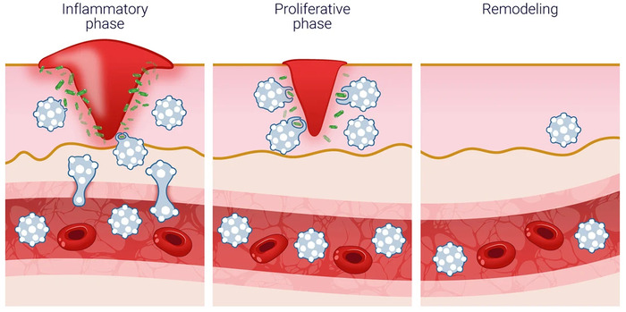 Healing and Tissue repair
