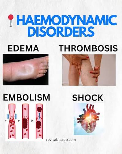Hemodynamic Disorders, Thromboembolism, and Shock