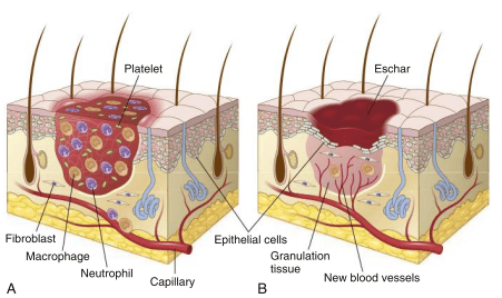 Histological cross-section of skin repair showing clot formation and granulation tissue ingrowth