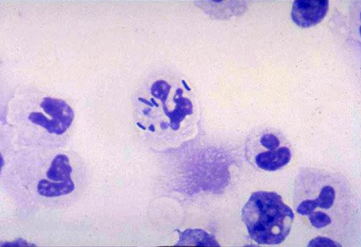 Microscopic Histology of Neutrophil Phagocytosis