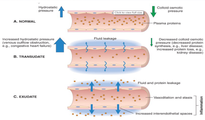 Microvascular Hemodynamic Changes and Fluid Movement