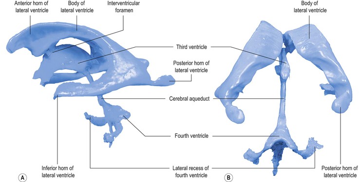 Three Dimensional Corrosion Cast of Ventricular Cavities