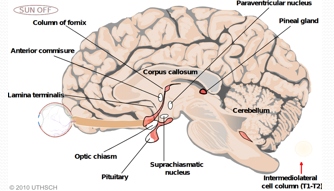 Pineal gland relation to dorsal midbrain and cerebral aqueduct