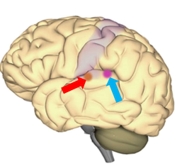 Primary Auditory Area and Auditory Association Area