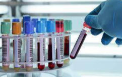Rack of phlebotomy vacutainer blood collection tubes