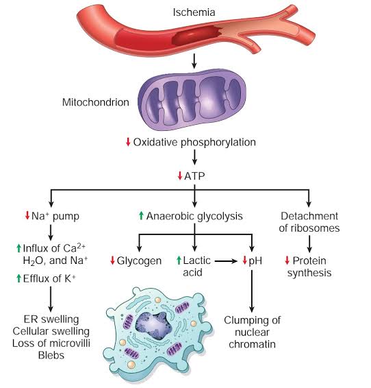 Robbins Figure 2-16 detailing the sequence of cellular events in hypoxic injury