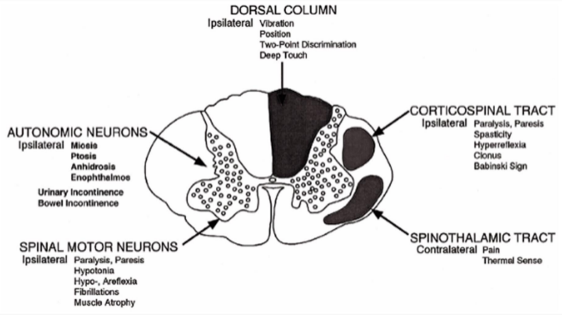 Clinically Important Spinal Cord Structures and Lesion Deficits