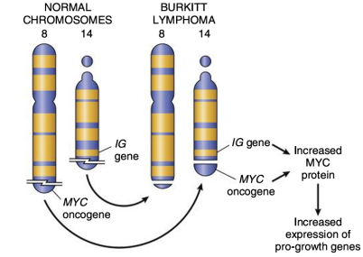 Schematic of chromosomal translocation t(8;14) in Burkitt lymphoma