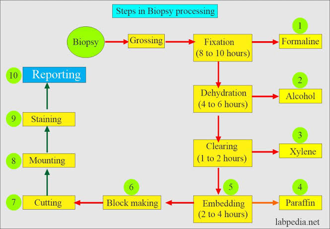 Steps in Biopsy Processing Flowchart