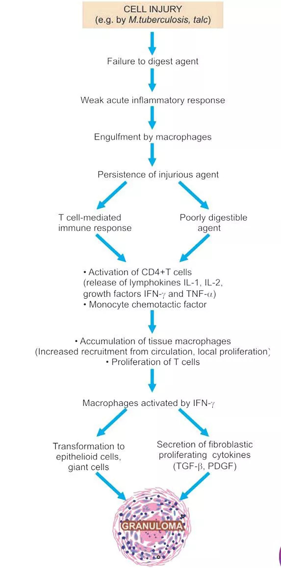 Stepwise flowchart of granuloma pathogenesis following cellular injury