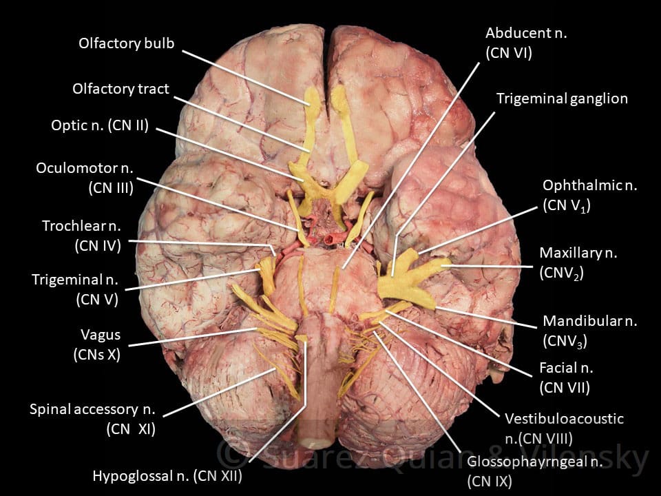 Ventral brain view showing cranial nerves and vasculature