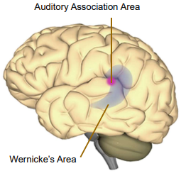 Wernicke's Area Topography