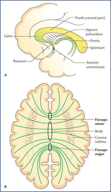 Corpus callosum sagittal parts and radiating fiber tracts