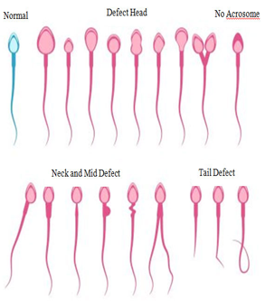 Morphology of Sperm Diagram