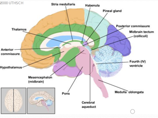Walls and boundary landmarks of the third ventricle